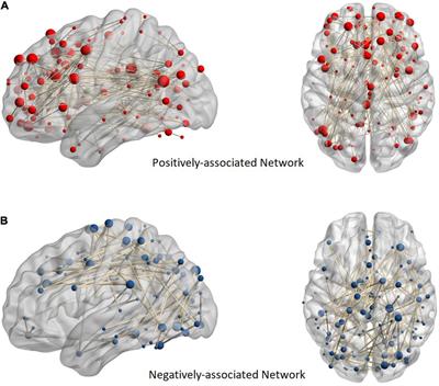 Abnormal Brain Network Interaction Associated With Positive Symptoms in Drug-Naive Patients With First-Episode Schizophrenia